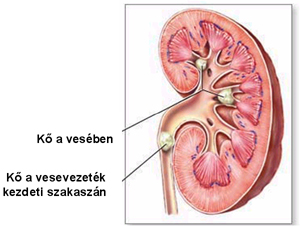 vesekő